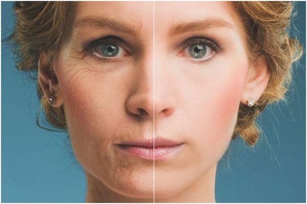 Techniques For Softening Or Removing Wrinkles