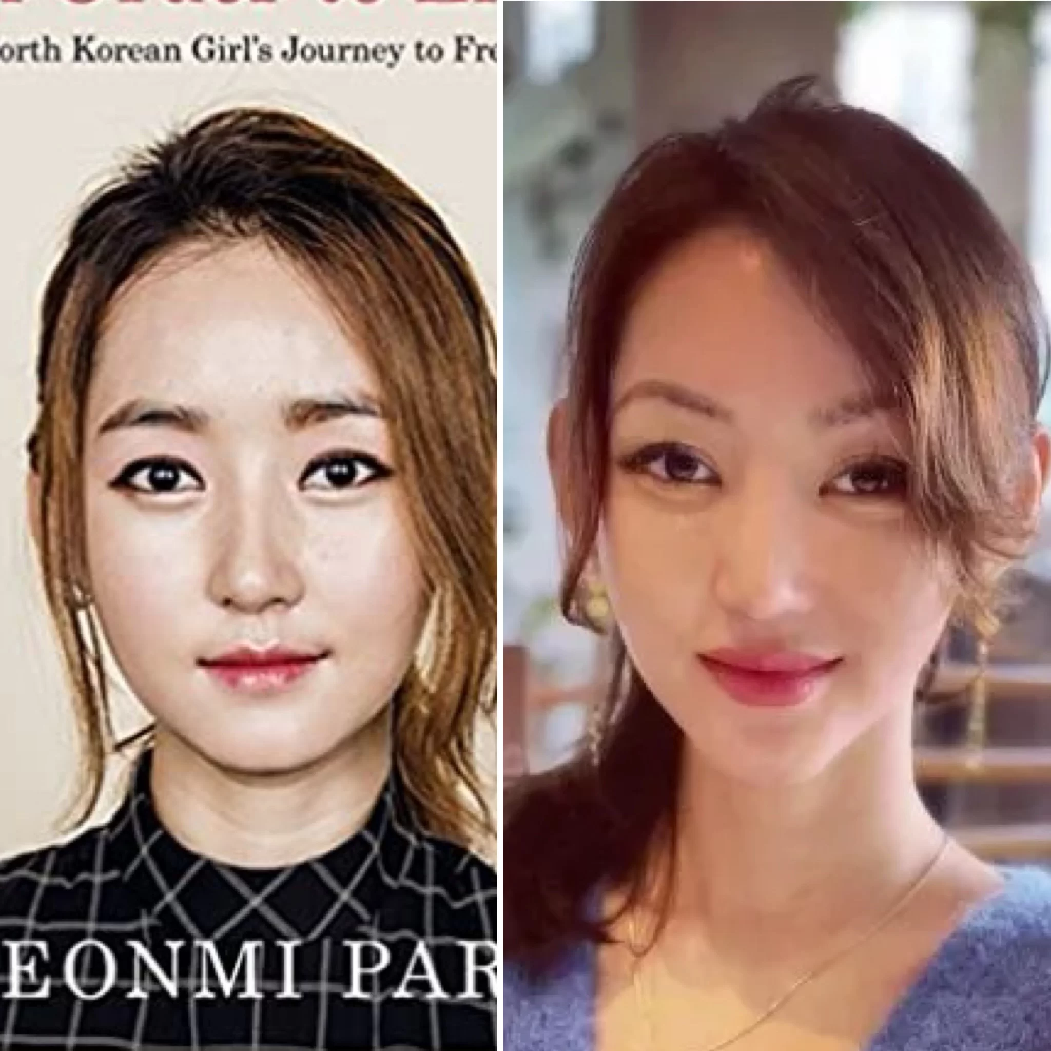 Yeonmi Park Surgery : the Real story behind plastic Surgery