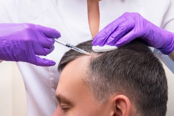 Art of Hair Restoration