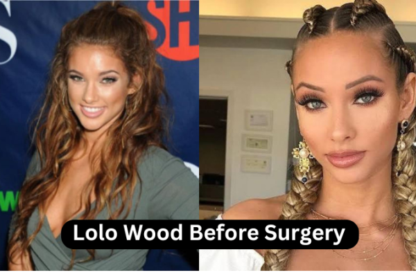 Lolo Wood Before Surgery