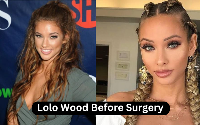 Lolo Wood Before Surgery