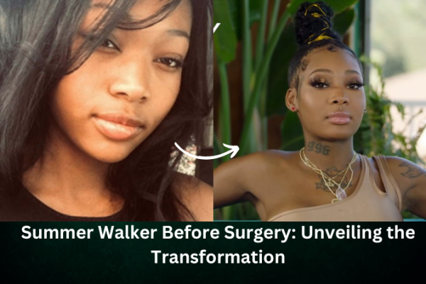 summer walker before surgery