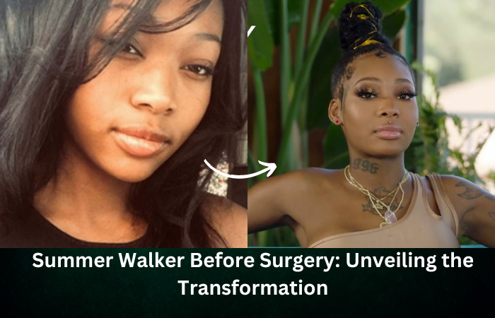 Summer Walker Before Surgery Unveiling The Transformation Genius Updates
